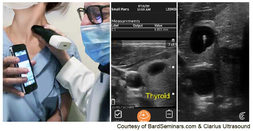 Portable handheld sonogram units in use